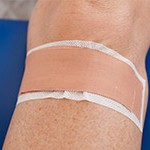 tendinitis rotuliana